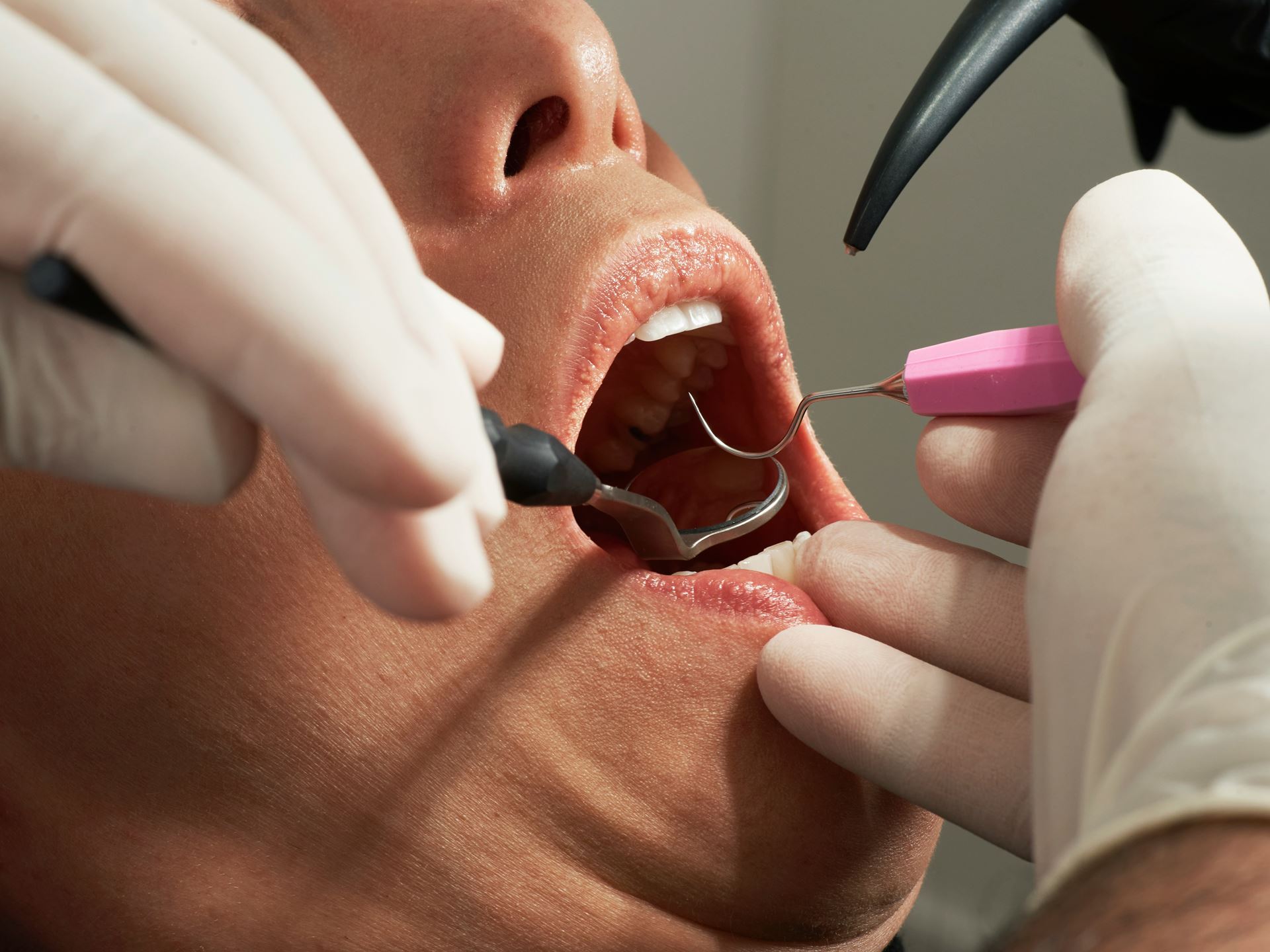 dental access