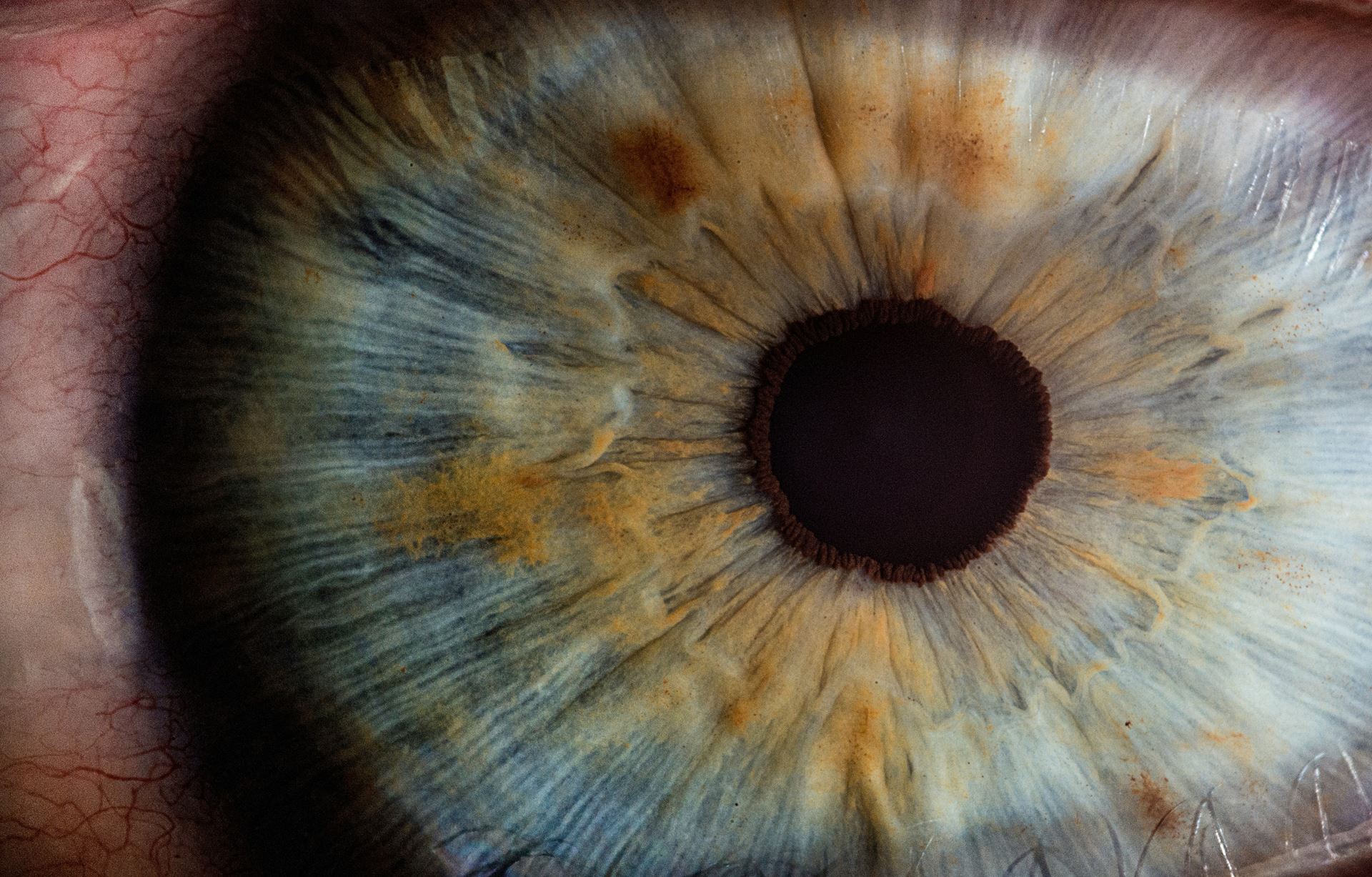 Eyes