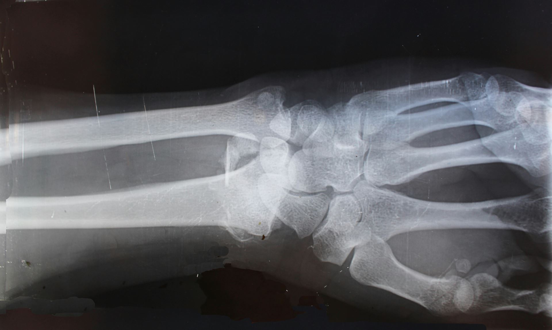 xray